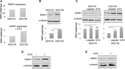 PARP1 Upregulation in Recurrent Oral Cancer and Treatment Resistance